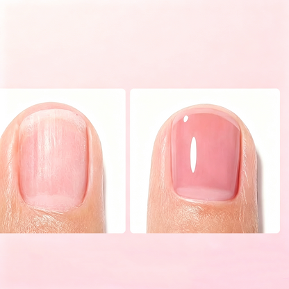 🔥Last Day Buy 1 Get 1 Free $ 9.99 Each🔥💅 Professional Milk Protein Nail Strengthener – Strengthening Treatment for Weak & Brittle Nails🛡️✨